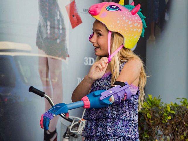 Impresión en 3D permite a niña tener prótesis de mano