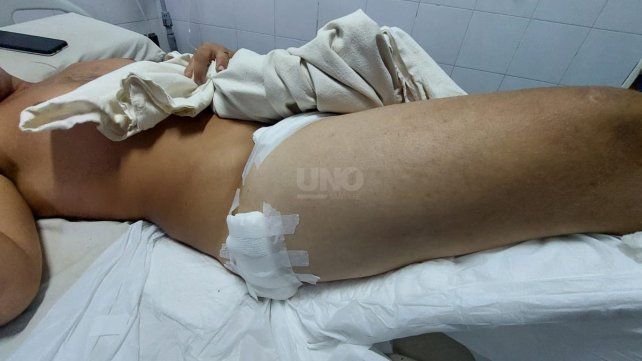 Uno de los tres sobrevivientes luego del tiroteo ocurrido en la tarde del martes en barrio Centenario que dejó a un joven asesinado&nbsp;