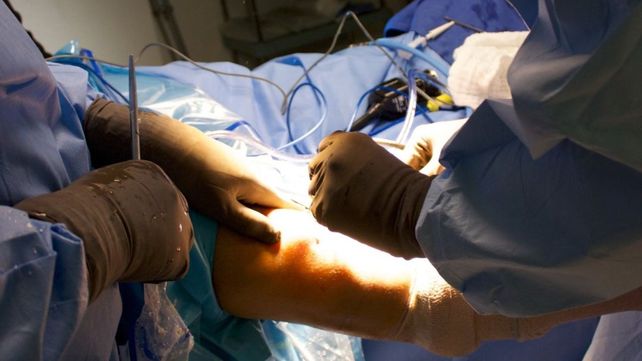 Insólito: una mujer denuncia que le operaron la rodilla equivocada