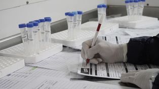 Coronavirus: informaron 417 muertos y 22.651 nuevos casos en la últimas 24 horas en Argentina