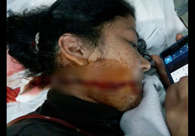 Con un bisturí, le atravesó el rostro a la ex mujer de su amante Con un bisturí, le atravesó el rostro a la ex mujer de su amante