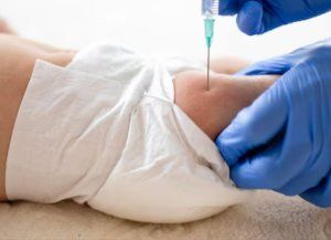 Los casos de tos convulsa en Argentina continúan en ascenso