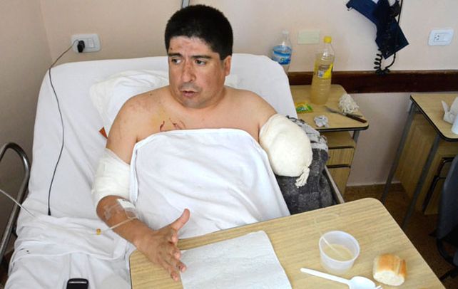 Un hombre de 43 años perdió el brazo izquierdo al ser atacado por un rottweiler.