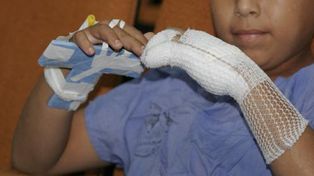 Sólo se registraron tres casos de niños heridos por pirotecnia en Santa Fe