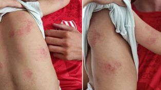 Las fotos que la mamá de la nena de 6 años subió a sus redes para hacer público lo ocurrido con su hija.