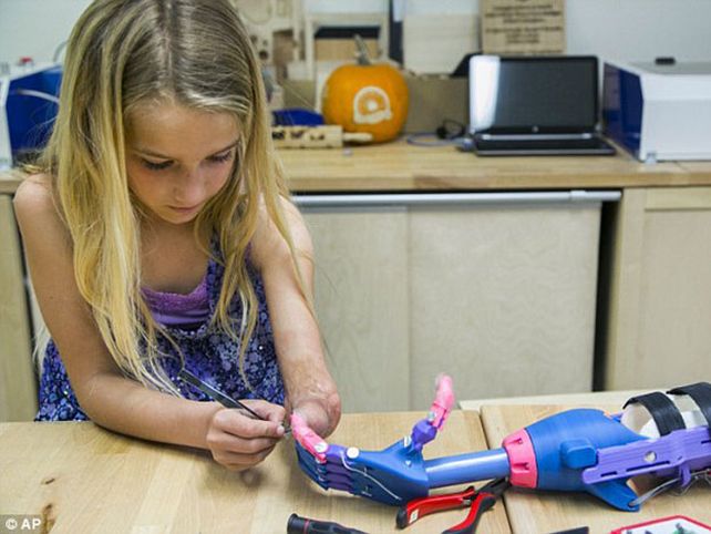 Impresión en 3D permite a niña tener prótesis de mano