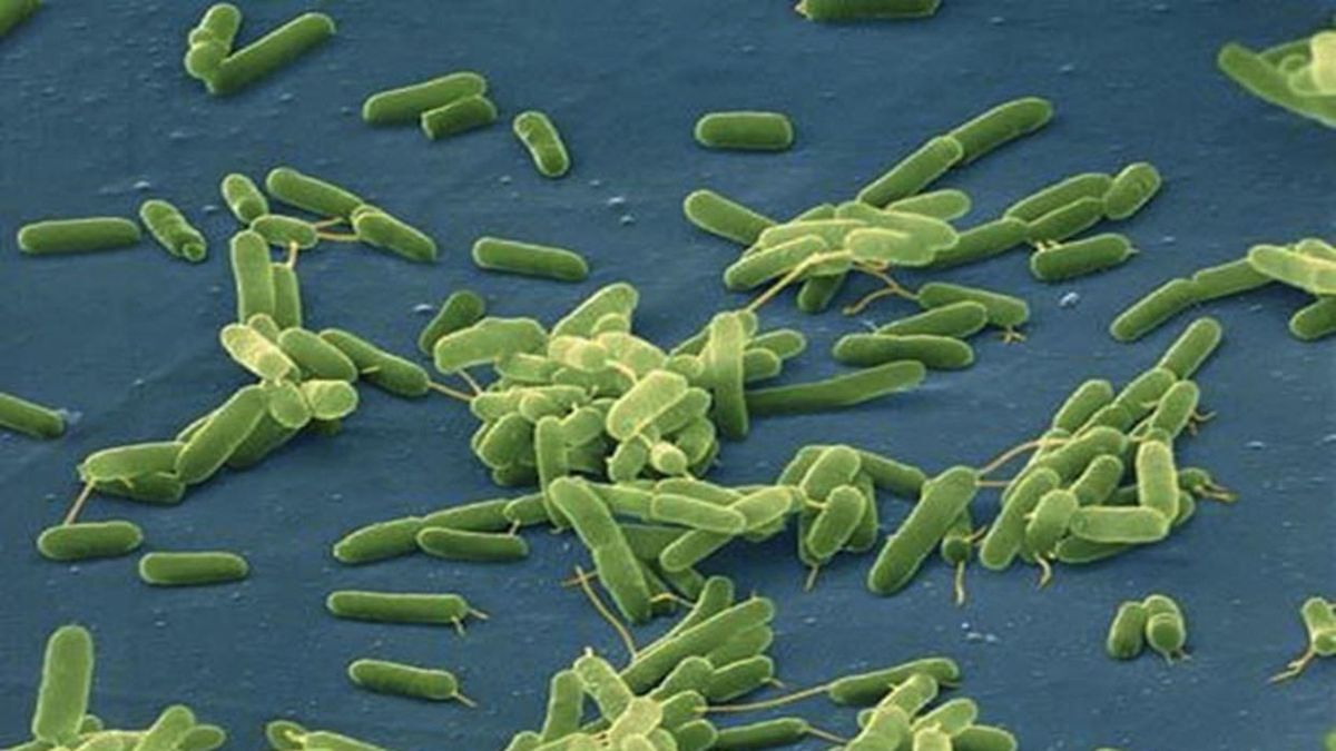 Florida Reportan cinco muertos y más de 20 infectados por bacteria