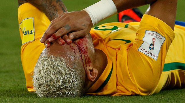 Durísimo: Neymar quedó bañado en sangre