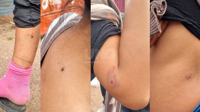 Las heridas de perdigones de escopeta que recibieron las víctimas del ataque en barrio Las Lomas