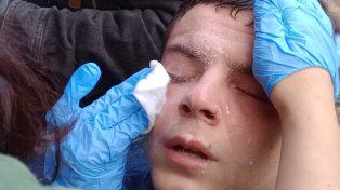 El fotógrafo Antonio Becerra que tomó imágenes de Santiago Caputo fue herido durante la marcha de jubilados frente al Congreso.&nbsp;