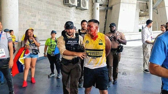 Varios hinchas colombianos fueron arrestados por los incidentes.