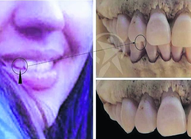 examen. Piezas dentarias publicadas por el diario El Tribuno de Salta.