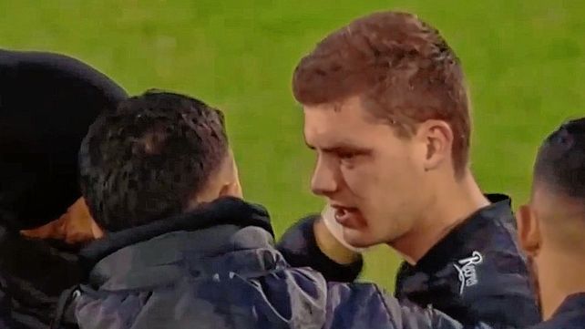 Colón informó sobre la lesión que sufrió Andrew Teuten y también Augusto Schott.