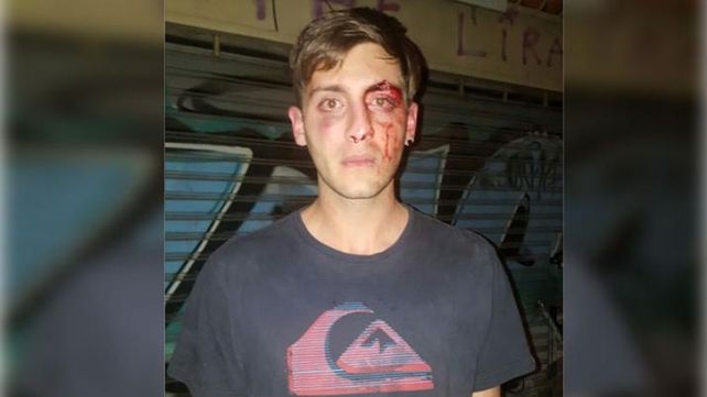 Un joven sufrió varias fracturas en la cara tras ser brutalmente atacado por patovicas