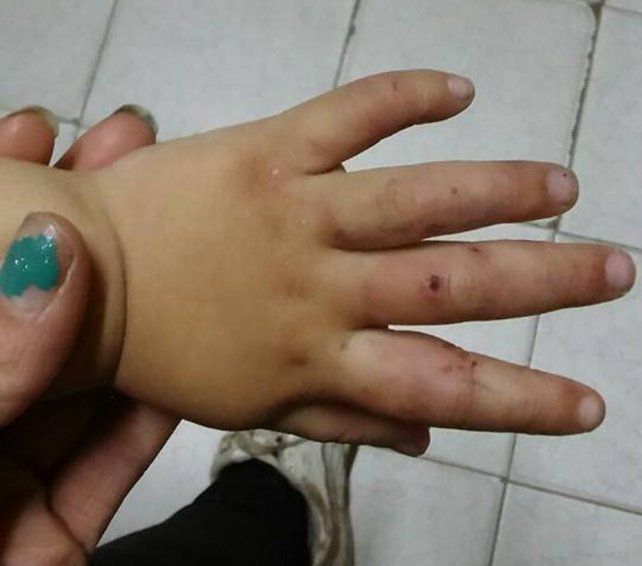Además de golpearla con la puerta
