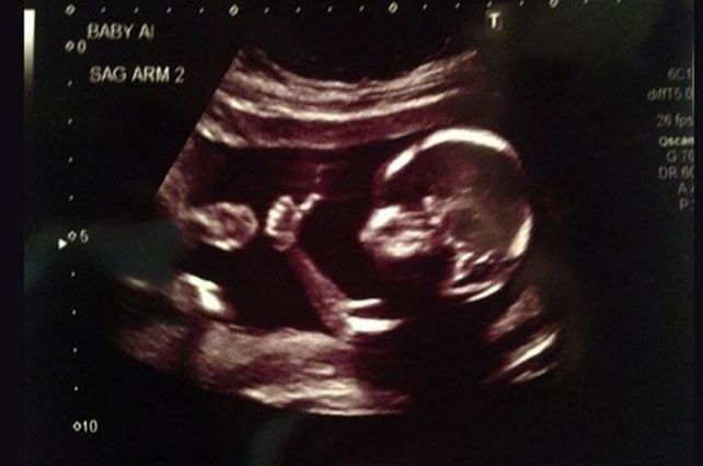 El bebé más cool que saluda en las ecografías