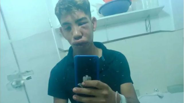 Cuatro jóvenes desfiguraron a otro tras una discusión de tránsito en Casilda