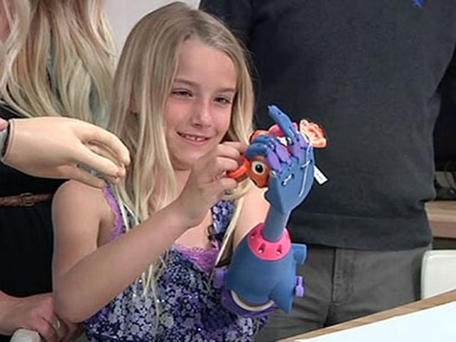 Impresión en 3D permite a niña tener prótesis de mano