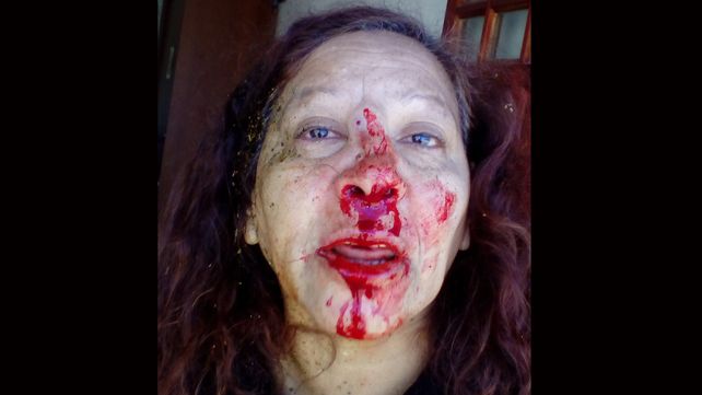Una discusión entre vecinos terminó con una mujer salvajemente golpeada