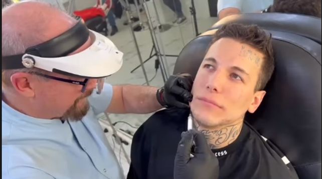 Video: Alex Caniggia quedó irreconocible tras realizarse una intervención estética