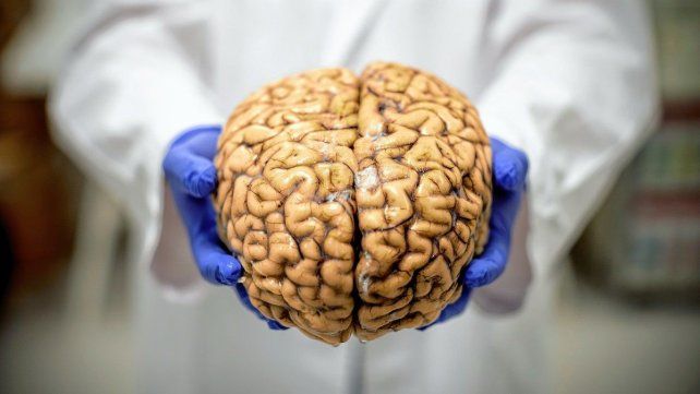 Hoy es el Día Mundial del Cerebro, esa máquina maravillosa del cuerpo humano Hoy es el Día Mundial del Cerebro, esa máquina maravillosa del cuerpo humano