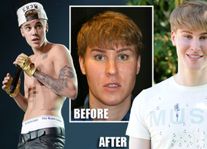 Un canadiense gastó cien mil dólares en cirugías para parecerse a Justin Bieber