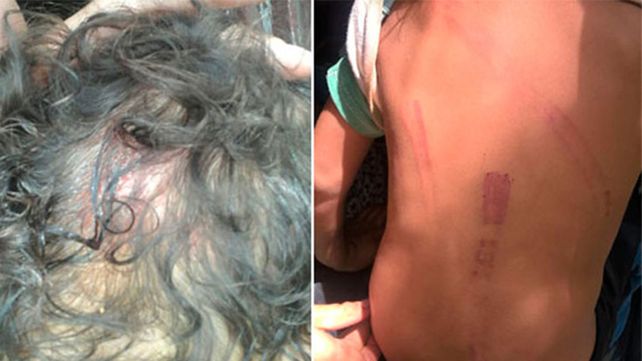 Imputaron a una mujer por torturar a sus hijos de 2, 4 y 6 años