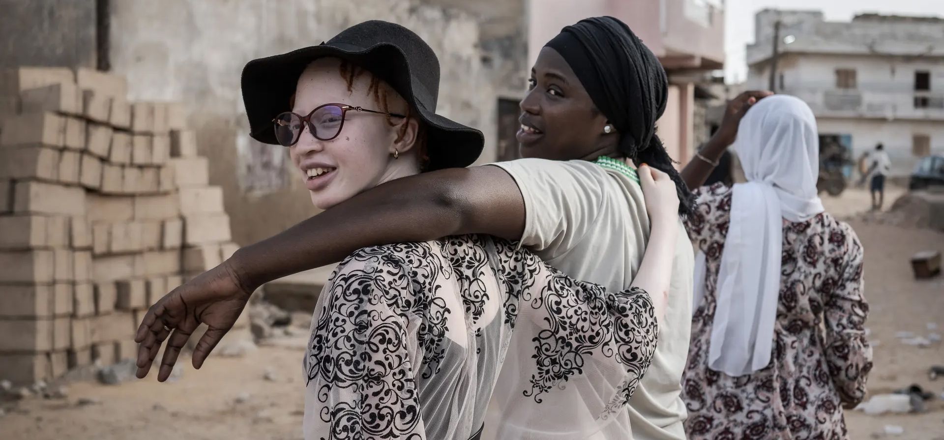 Dakar, Senegal. Penda Fall, de 13 años, es fotografiada en el Día Internacional de Concientización sobre el Albinismo. Penda dijo que quería convertirse en pediatra algún día para poder ayudar a otros niños que sufren de albinismo y otras enfermedades. Fotografía: Annika Hammerschlag/Anadolu / Getty Dakar, Senegal. Penda Fall, de 13 años, es fotografiada en el Día Internacional de Concientización sobre el Albinismo. Penda dijo que quería convertirse en pediatra algún día para poder ayudar a otros niños que sufren de albinismo y otras enfermedades. Fotografía: Annika Hammerschlag/Anadolu / Getty