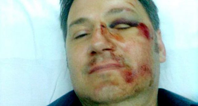 Un estudiante y su madre golpearon ferozmente al director de la escuela