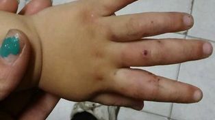 Una joven denunció que su pareja mordió y golpeó con un palo a su hija de 3 años y reclama su detención