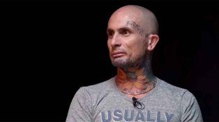 Ahora el cantante de Ke Personajes sufrió un accidente
