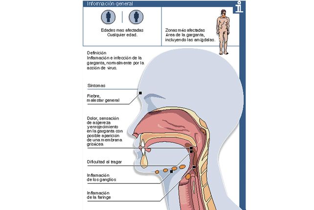 ¿Cómo es el cuadro de salud que padece la Presidenta?