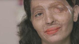 Una mujer india atacada con ácido desfilará en la New York Fashion Week