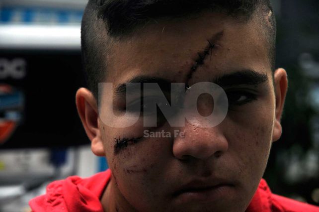 Revelador. La indeleble marca de la sutura de 12 puntos