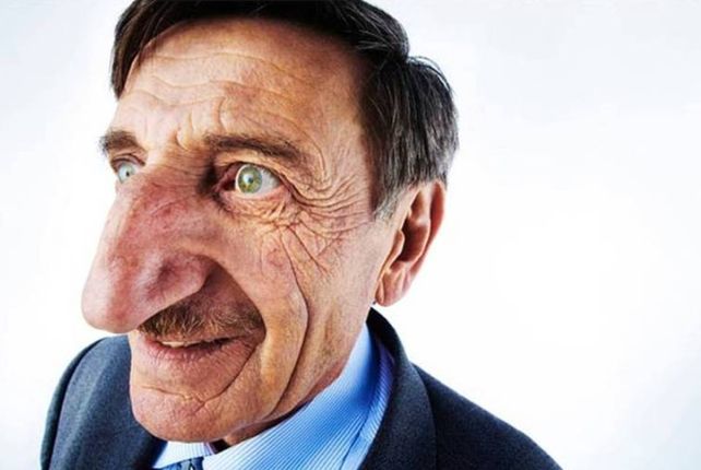 Un turco es el hombre con la nariz más larga del mundo: ¿cuánto mide?