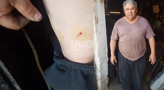 Mató a un caniche y mordió a dos personas