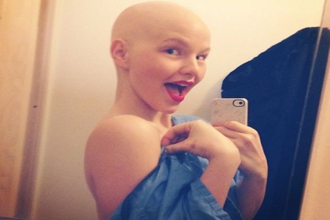 Una modelo con cáncer se muestra sin pelo en sus campañas