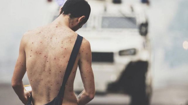 Una foto viral que muestra la violencia en Venezuela