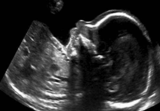 El tierno mensaje desde la panza que un bebé le mandó a sus papás