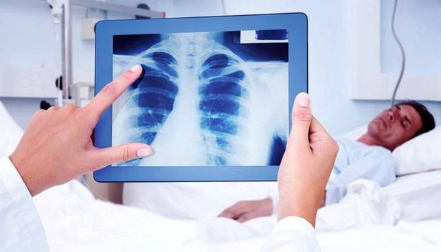La tuberculosis es una enfermdedad que afecta a los pulmones y puede comprometer la vida&nbsp;