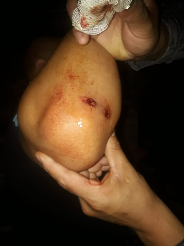 Balearon a un policía en un allanamiento en barrio Los Troncos