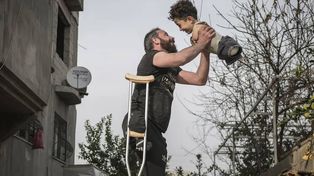 La impactante foto que ganó un premio internacional: Los sufrimientos de la vida