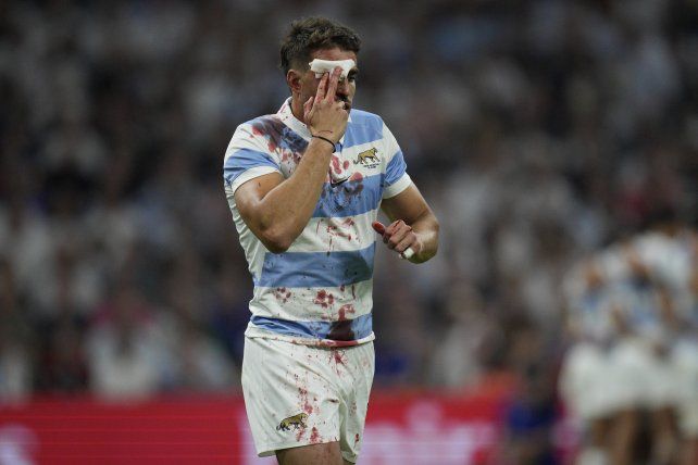 El fullback Juan Cruz Mallía sufrió un corte en su cabeza en los primeros minutos del partido.&nbsp;