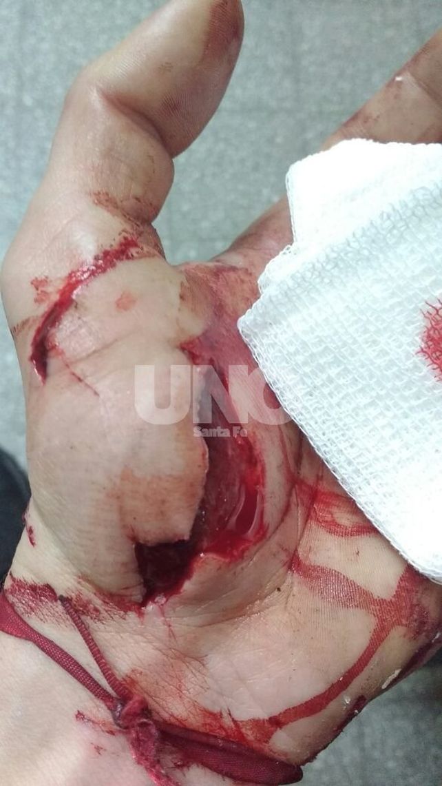 Grave lesión a un policía durante la aprehensión de un violento delincuente