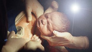 Se cort&oacute; la luz en el hospital y con su celular alumbr&oacute; el nacimiento de su hijo