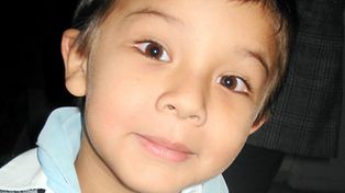 La Justicia ordena al Estado pagar la operaci&oacute;n de un ni&ntilde;o en EEUU