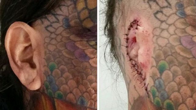 Un hombre se sometió a una serie de dolorosas operaciones para transformarse en dragón