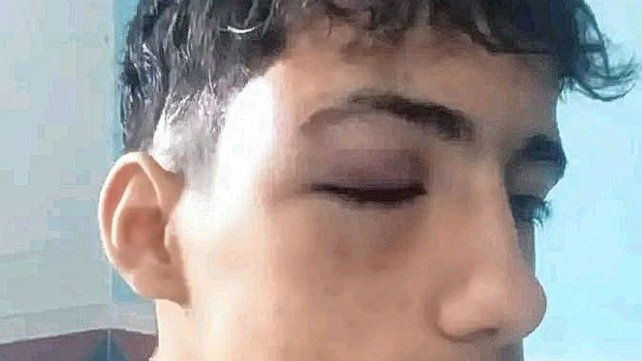 El joven golpeado.