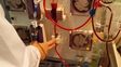 Tenía tanta grasa en la sangre que lo salvaron con una sangría