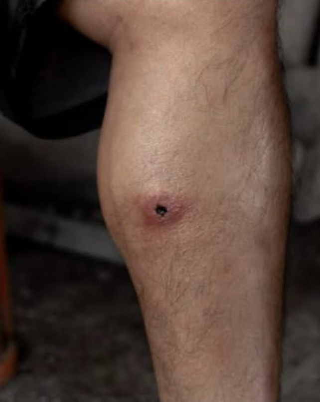 Un hombre fue baleado por su cuñado el noroeste de la ciudad